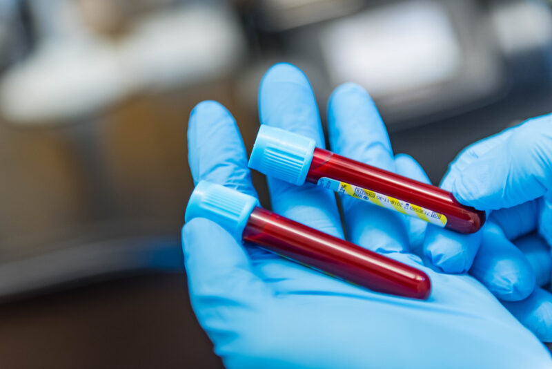 New blood – UBC researchers develop process that could make blood types ...