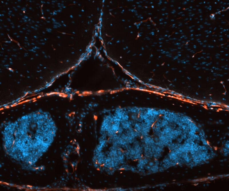 An immunostaining image from Ebert's research shows cells in red, covering the brain, which appears as blue shapes.